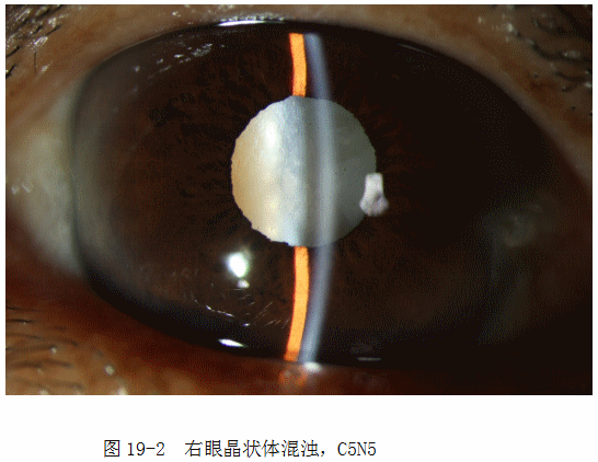 ZY016_96_2.gif